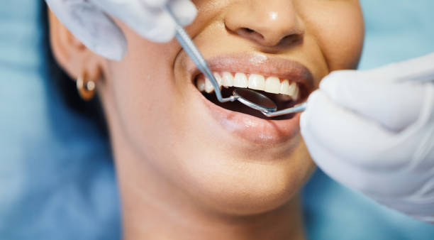 Best Chipped Tooth Repair Near Me  in Carleton, MI